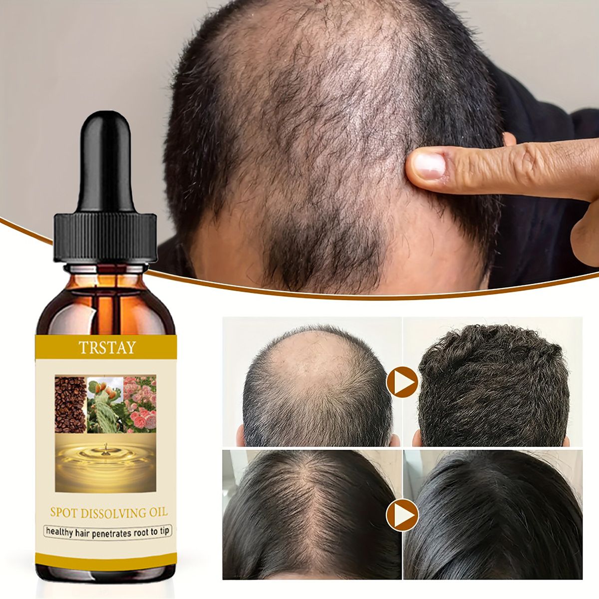 50ML 수염 성장 오일 남성 여성을 위한 탈모증 모발 - Beard Oil 리뷰 및 가격